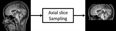 On the reliability of deep learning-based classification for Alzheimer’s disease: Multi-cohorts, multi-vendors, multi-protocols, and head-to-head validation